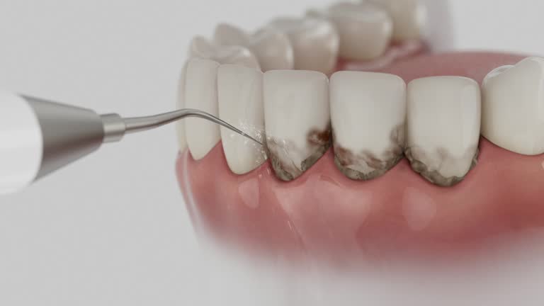 Trusted Tooth Extraction service in Harrison, AR - Dentist Open Now